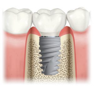 Sydney Implant Studio photo 2