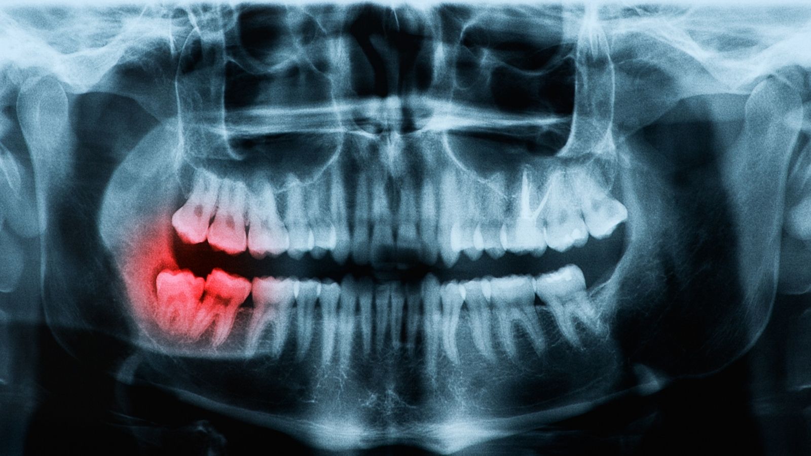 Sydney Oral Maxillofacial Surgery photo 2