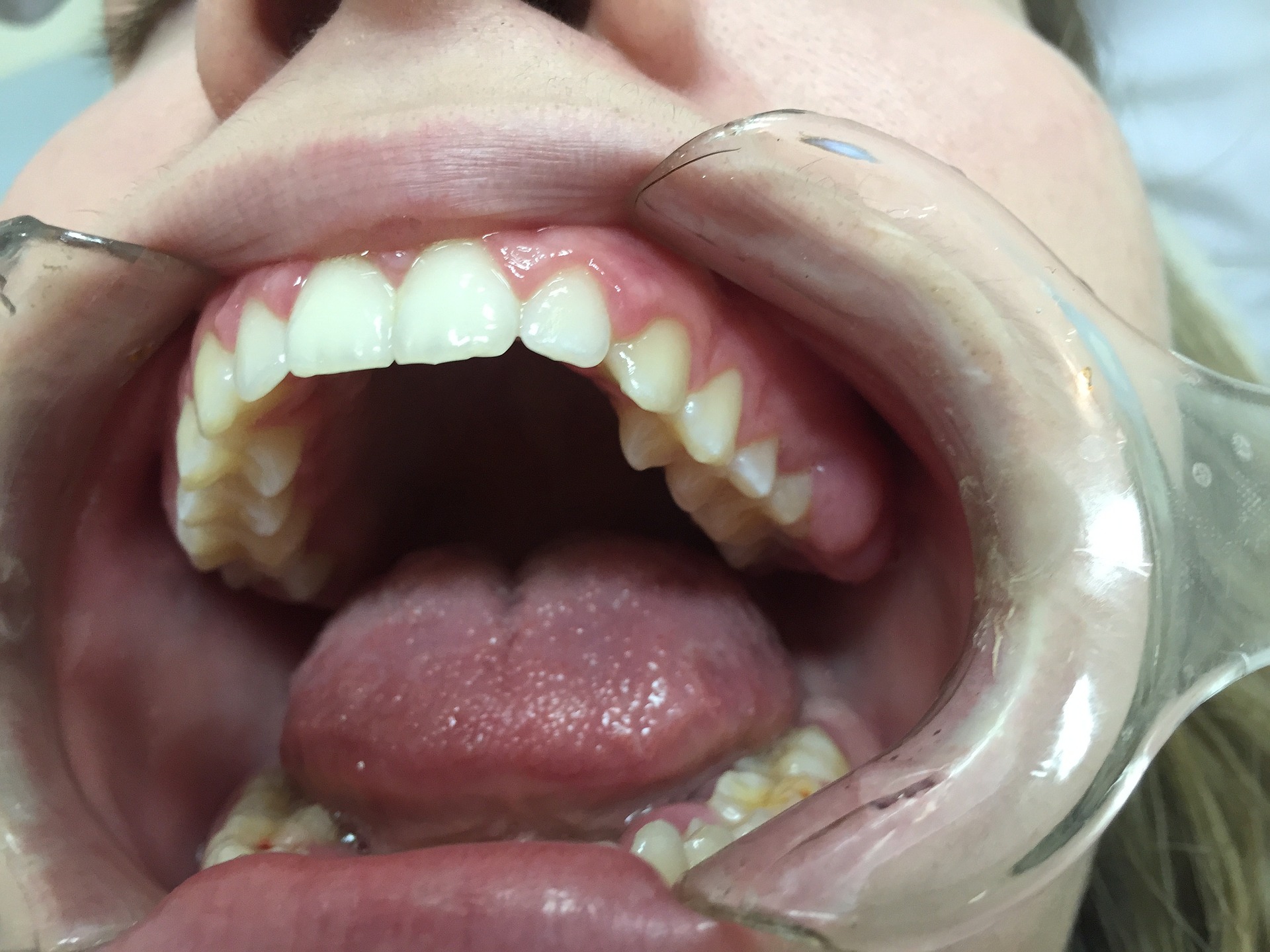 noel elmowy dental surgeon photo 4