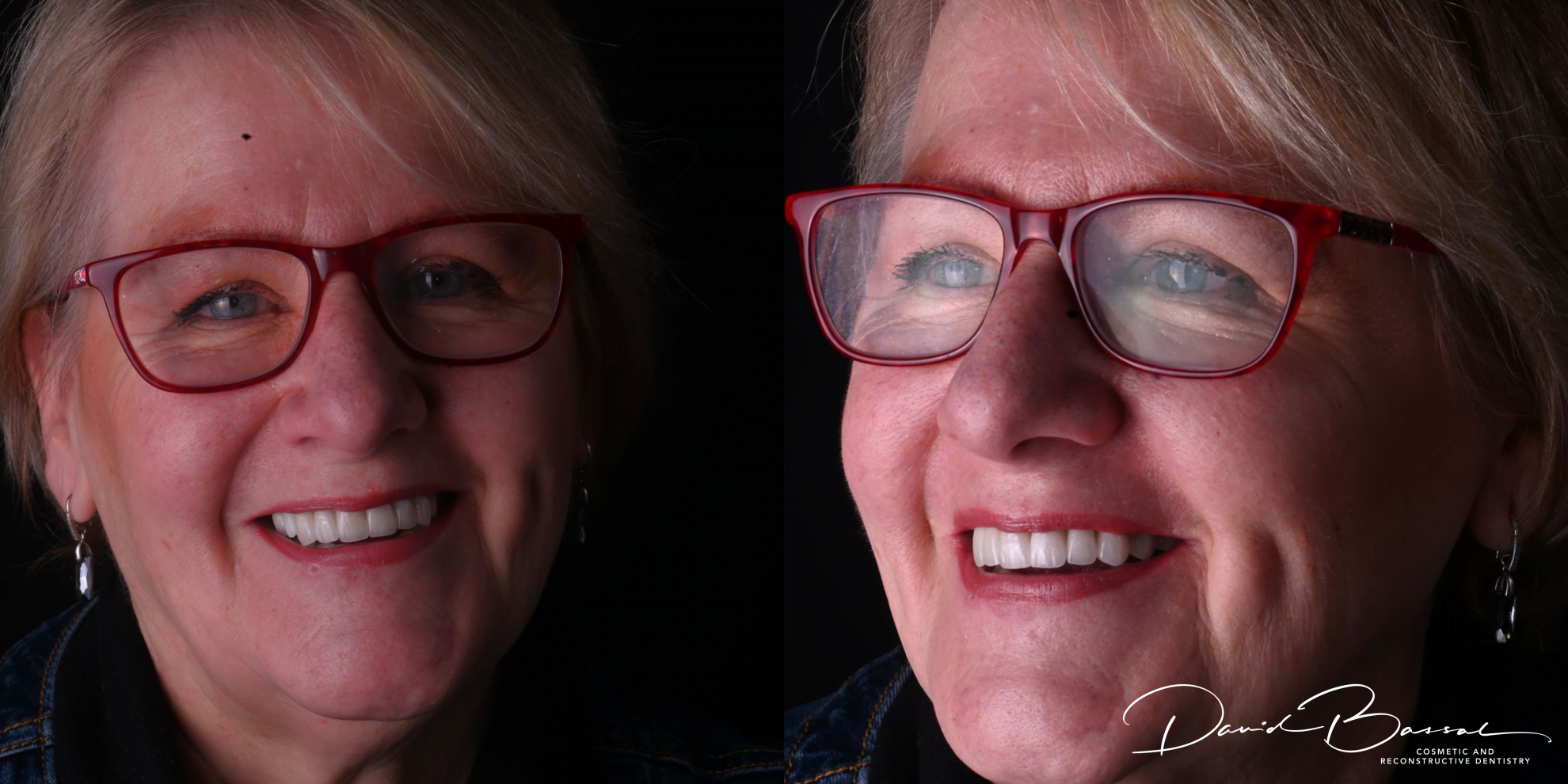 Bonnells Bay Dental photo 3