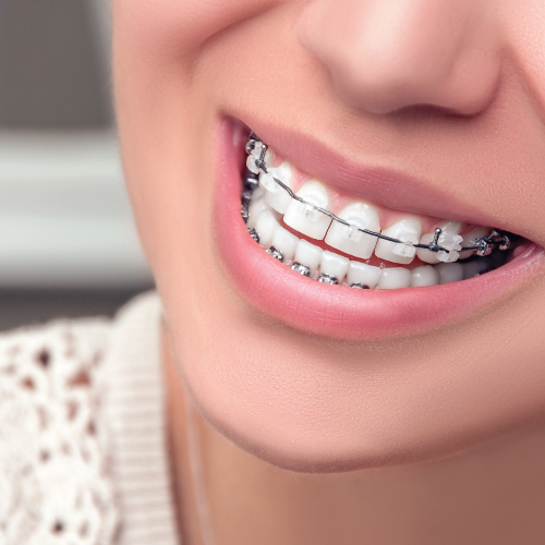 Dental Pro photo 4