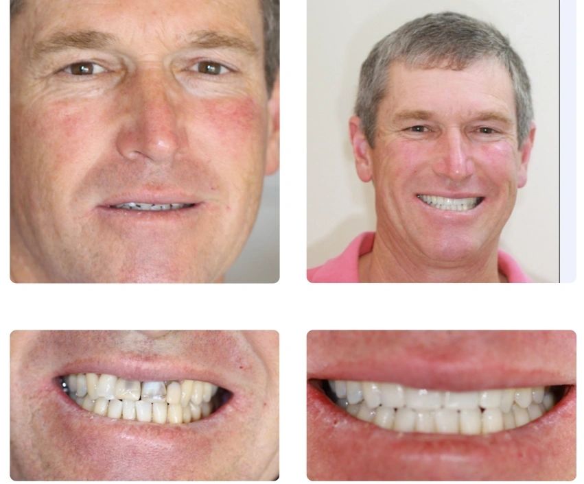 PlanetSmiles Dr Lynette Wallace Dentist photo 3