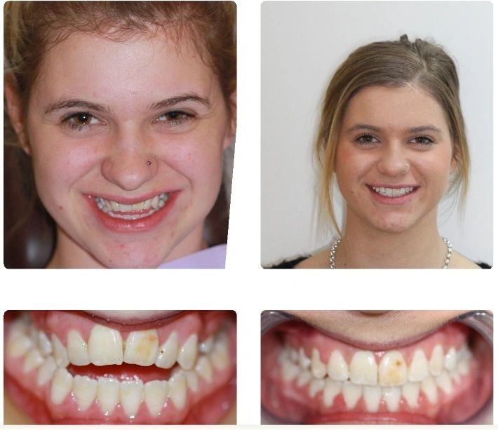 PlanetSmiles Dr Lynette Wallace Dentist photo 4