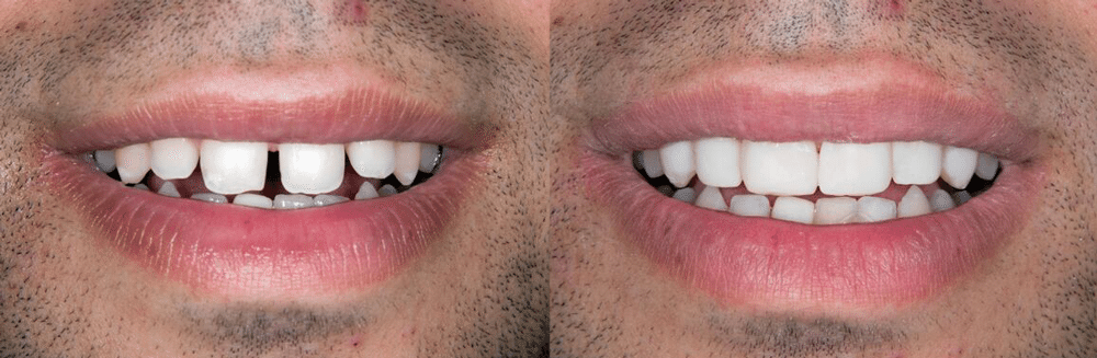 Braddon Dental Surgery photo 4