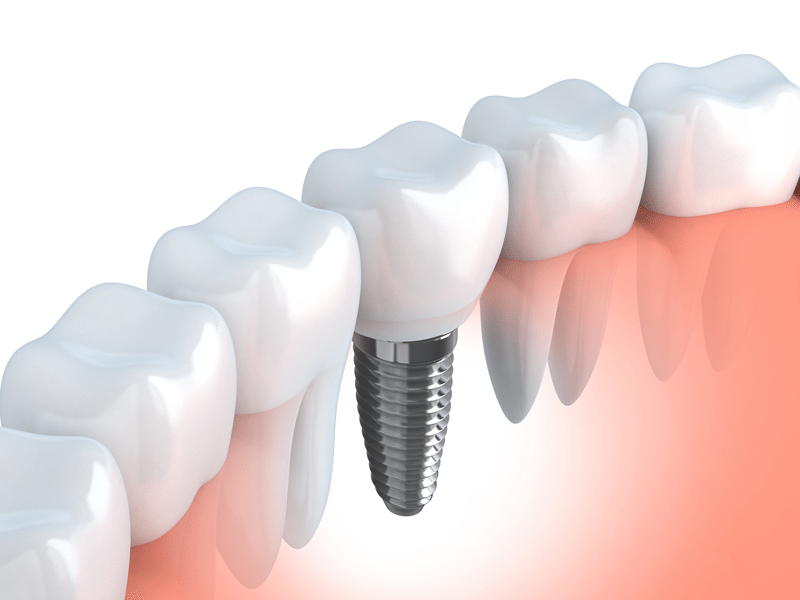 Braddon Dental Surgery photo 3