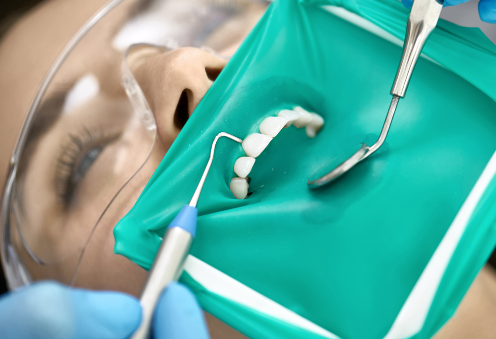 Endodontics photo 4
