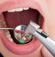 Love Dental Brighton photo 4