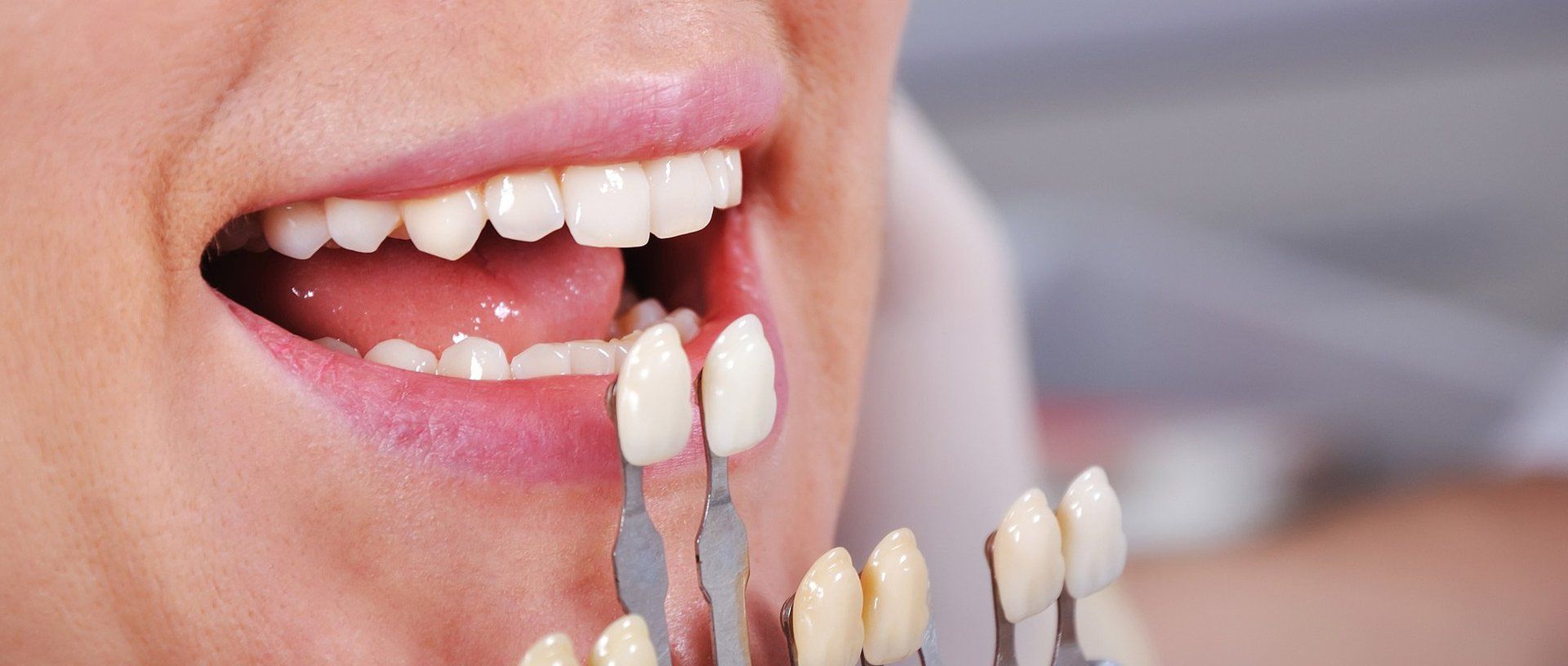 Brighton Dental Care photo 4