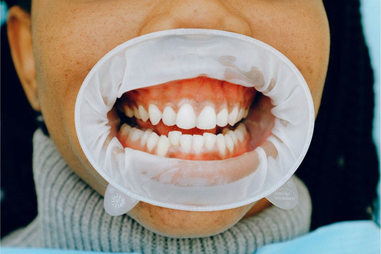 Arise Dental photo 3