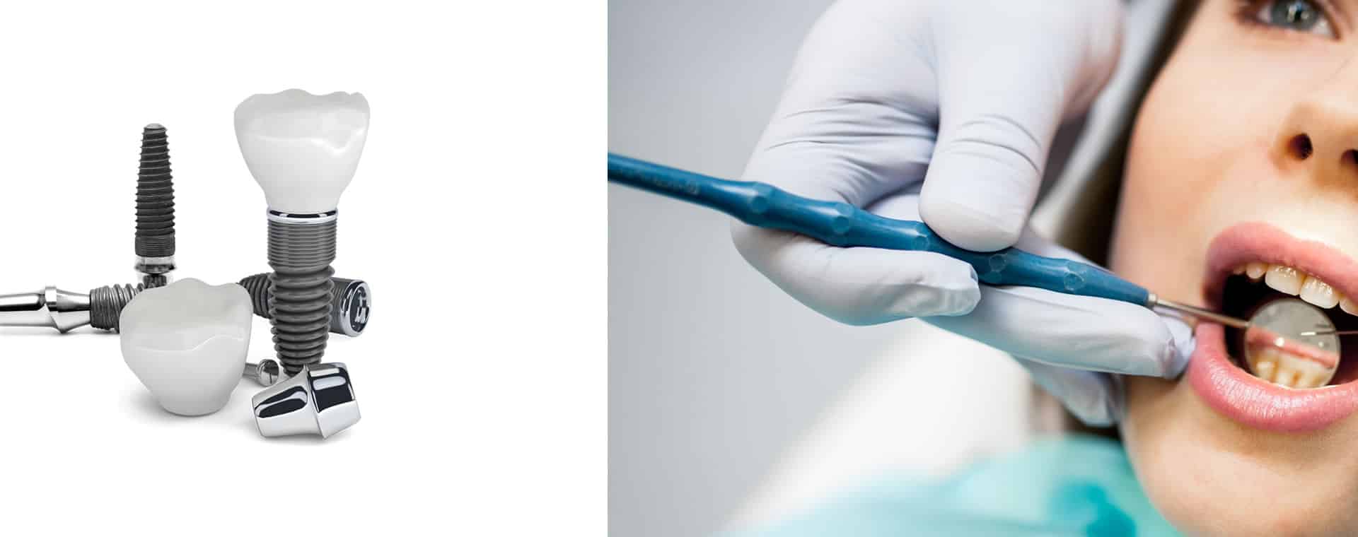 Skygate Dental photo 3