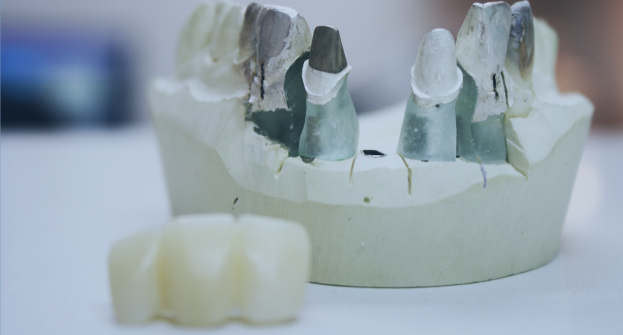 JB Prosthodontics photo 4