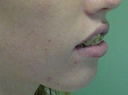 Dentofacial photo 4