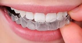 ABC Orthodontics-SPECIALIST ORTHODONTISTS photo 3
