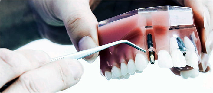 Australian Family Dental photo 3