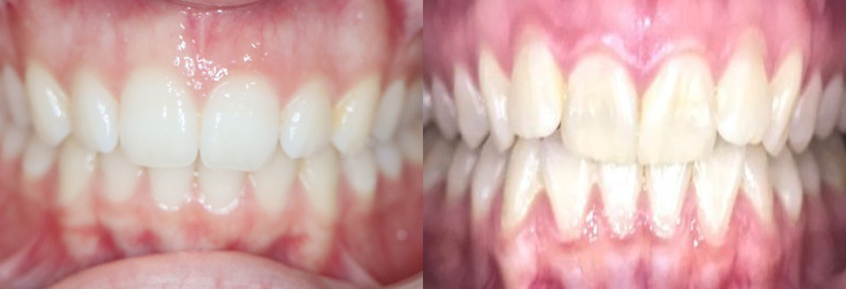 Brookwater Dental Surgery photo 3