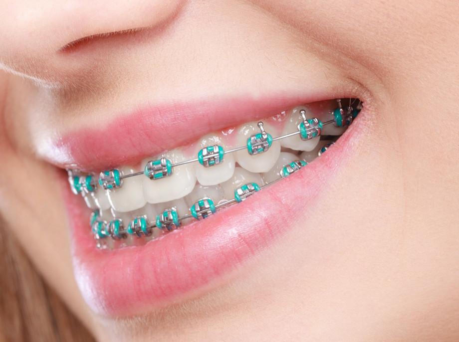 Greater Springfield Orthodontics photo 1