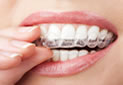 Browns Plains Dental Centre photo 2