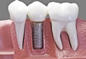 Browns Plains Dental Centre photo 4