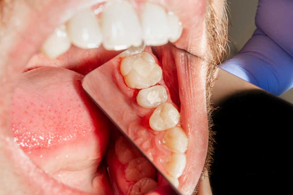 Mountain Top Dental photo 4