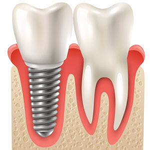Spencer Family Dental photo 3