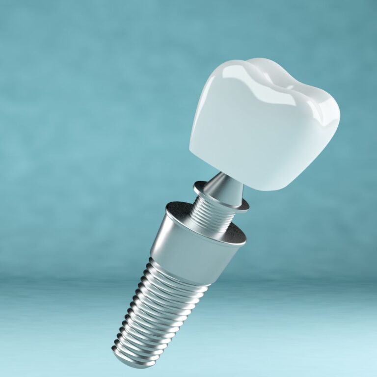 Harvie Dental photo 3