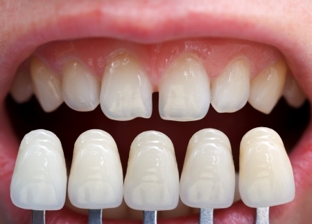 Burpengary Dental photo 4