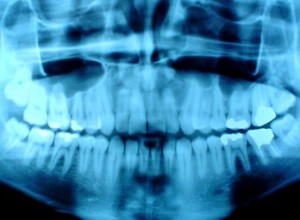 Burwood Dental Specialists photo 3