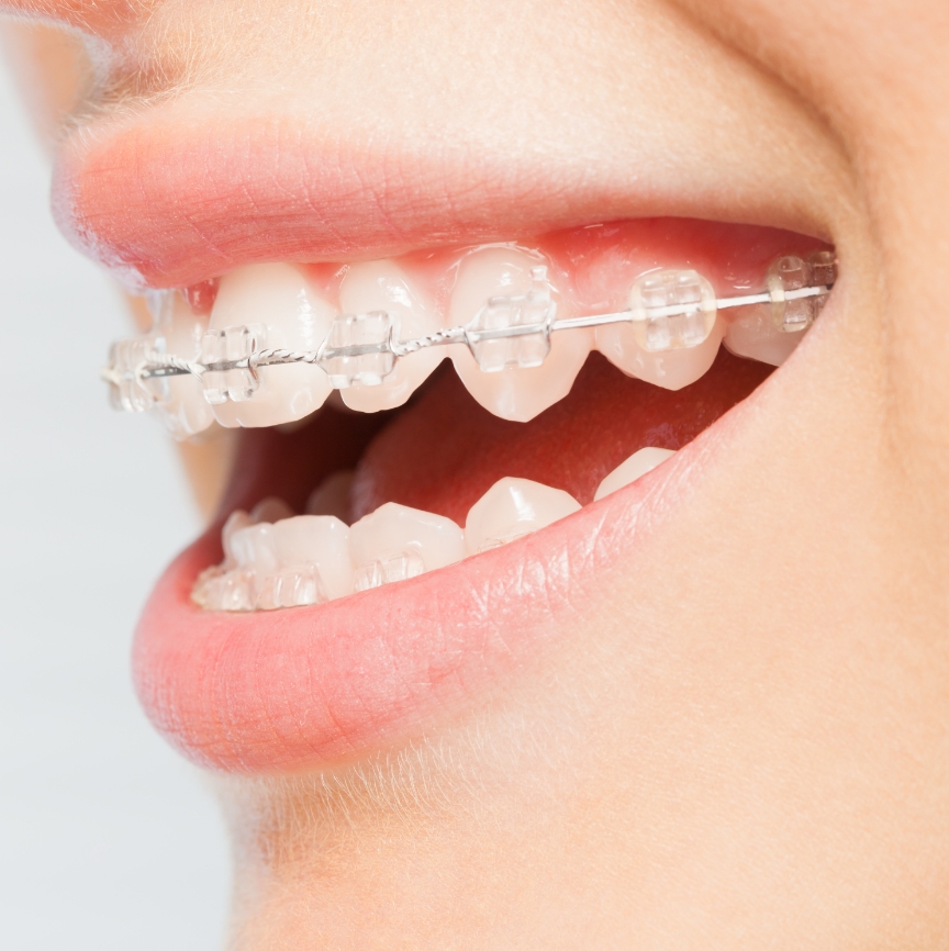 Arc Orthodontic Specialists photo 3