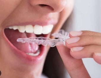 Glow Orthodontics photo 3