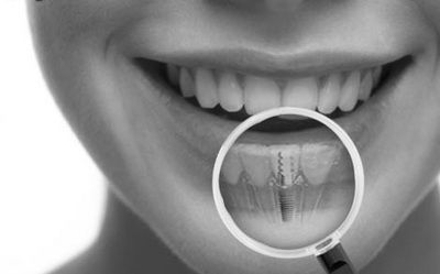 Beenyup Dental photo 3
