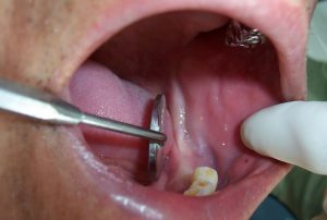 Cabramatta Dental Studio photo 3