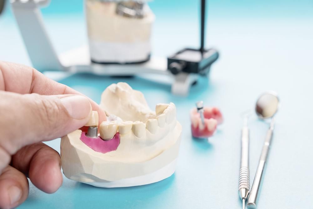 Cairns Denture Service photo 4