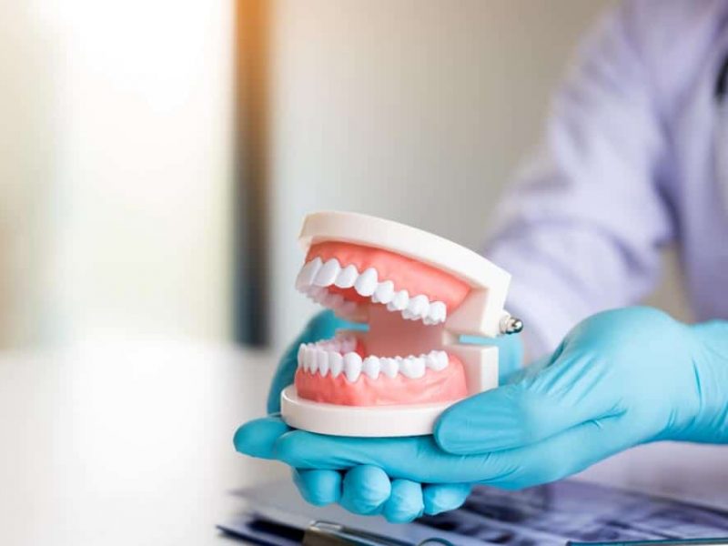 Perfect Teeth photo 2