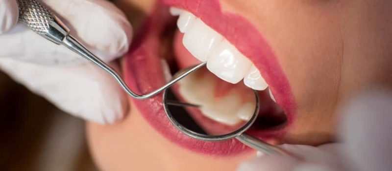 Perfect Teeth photo 4