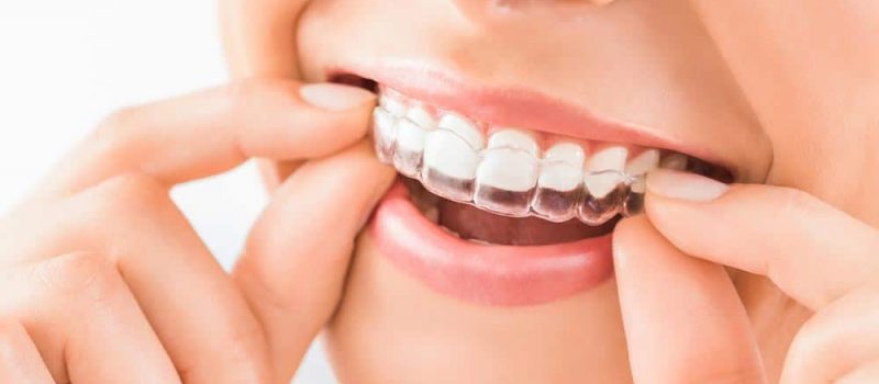 Perfect Teeth photo 3