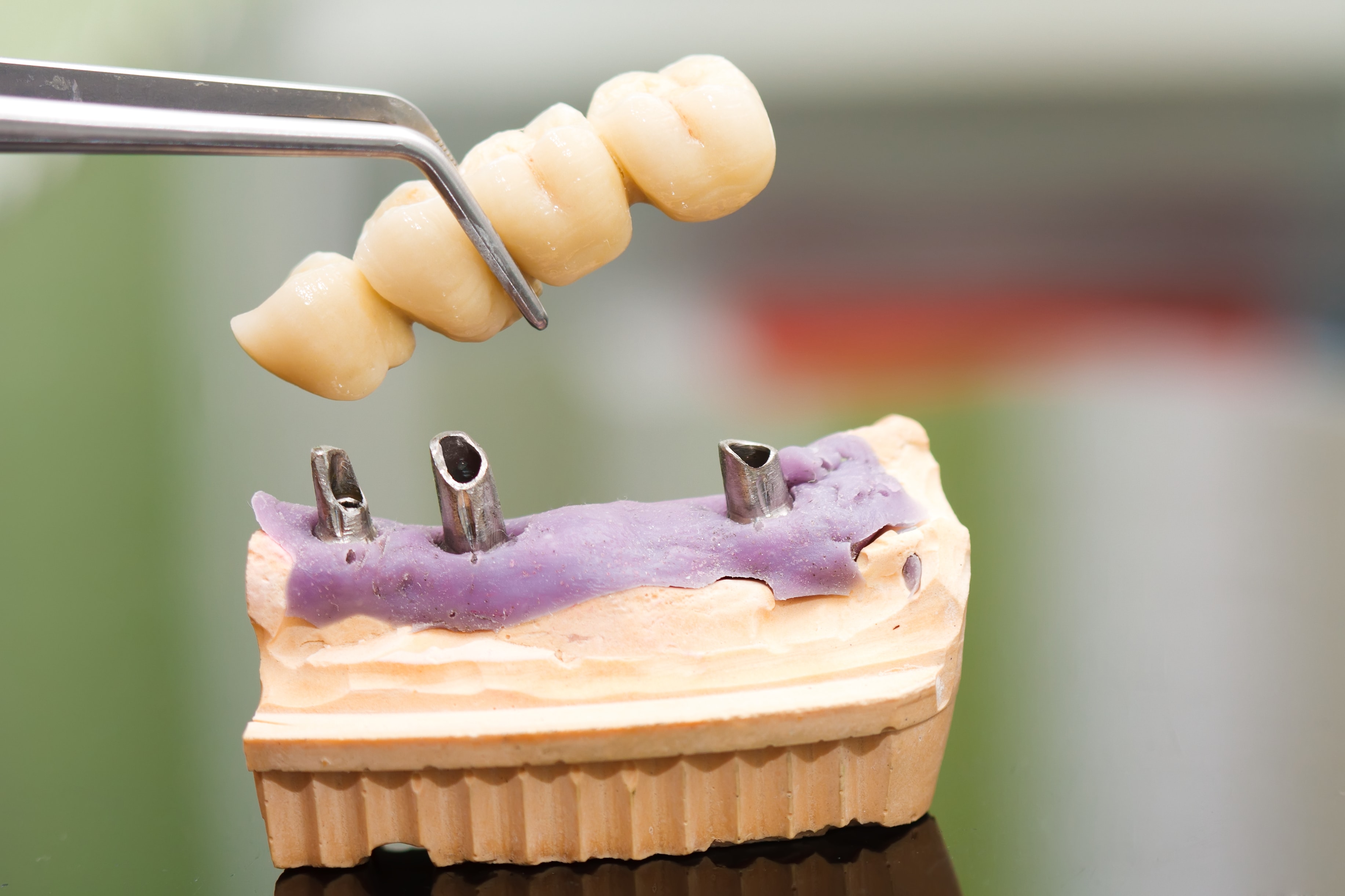 Golden Beach Dental photo 4