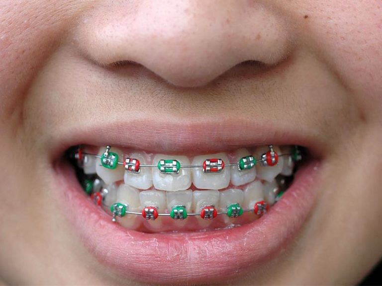 Clear Choice Orthodontist photo 3