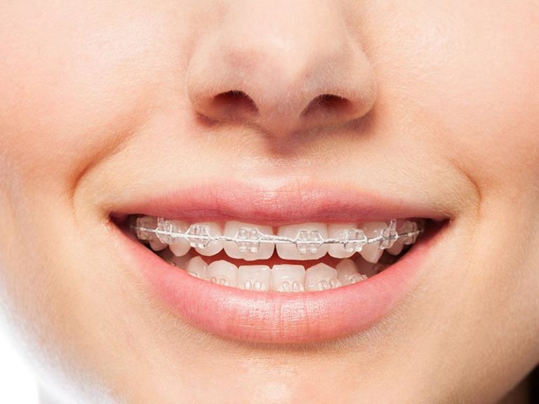 Clear Choice Orthodontist photo 4