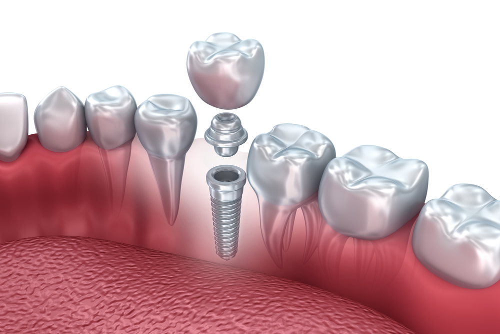 Camden Dental Centre photo 1