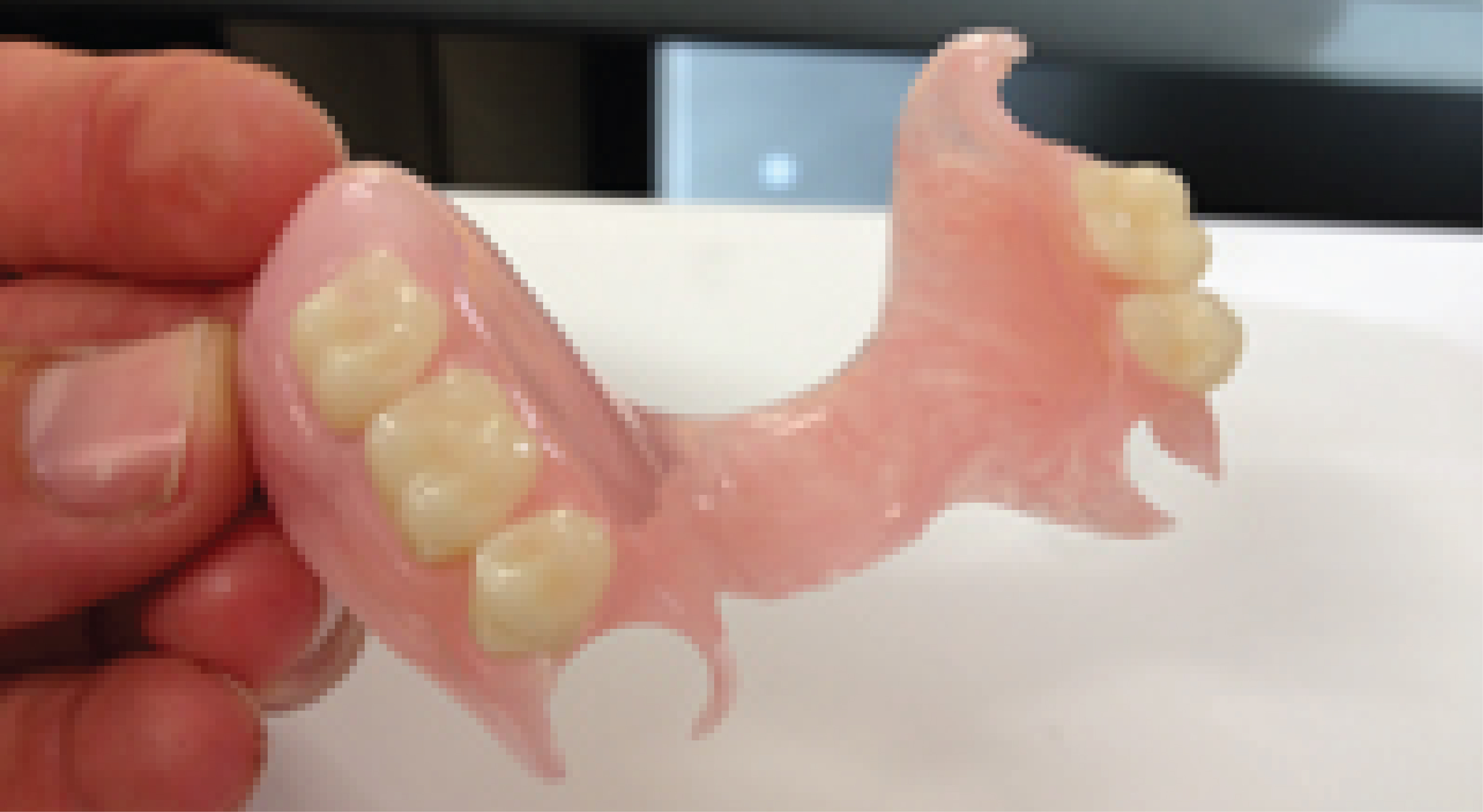 Dentacast Denture Clinic photo 2