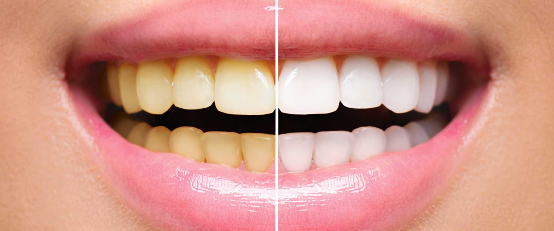 Canberra Dental Care photo 3