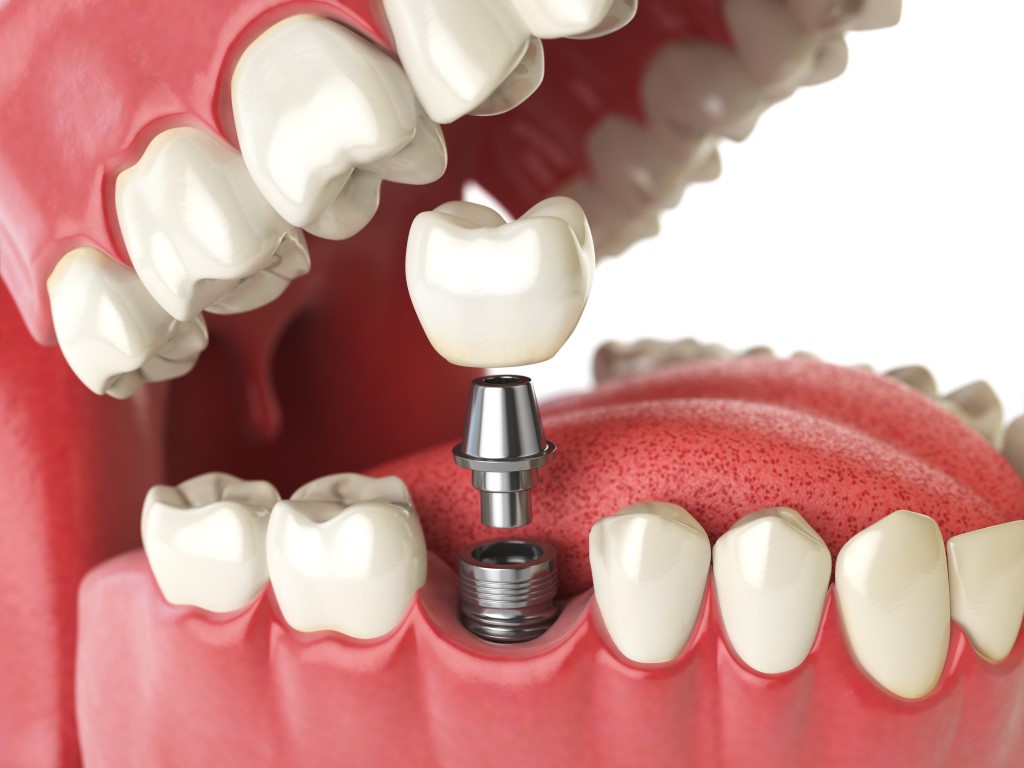 Hobart Place Dental photo 2