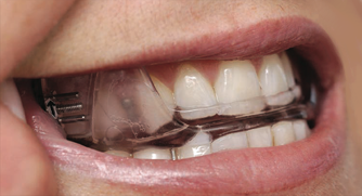 Canning Vale Dental Centre photo 3