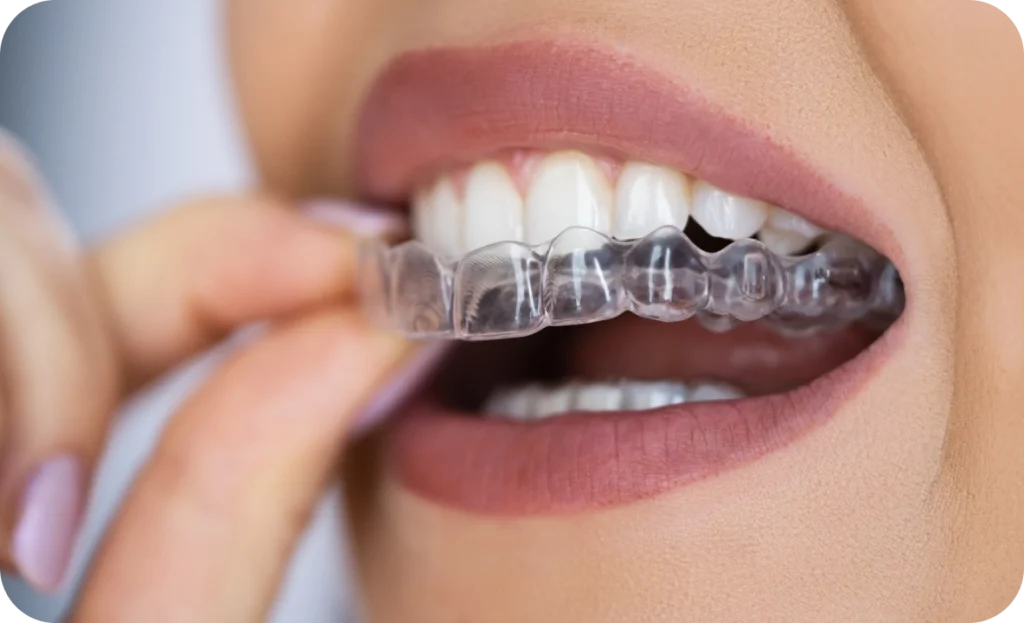 Redlands Gentle Dental Care photo 3