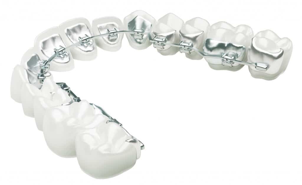 Inline Orthodontics photo 4