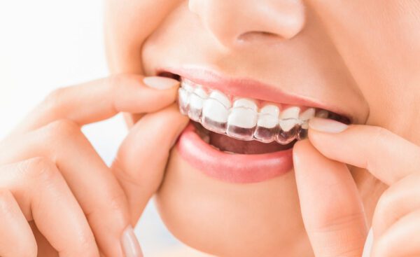 Carlton Dental photo 4