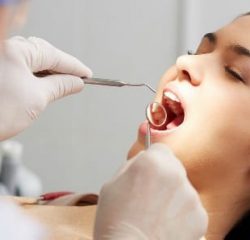 WISDOM TEETH EXTRACTION photo 3