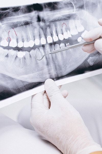Coomera Smileco Dental photo 2
