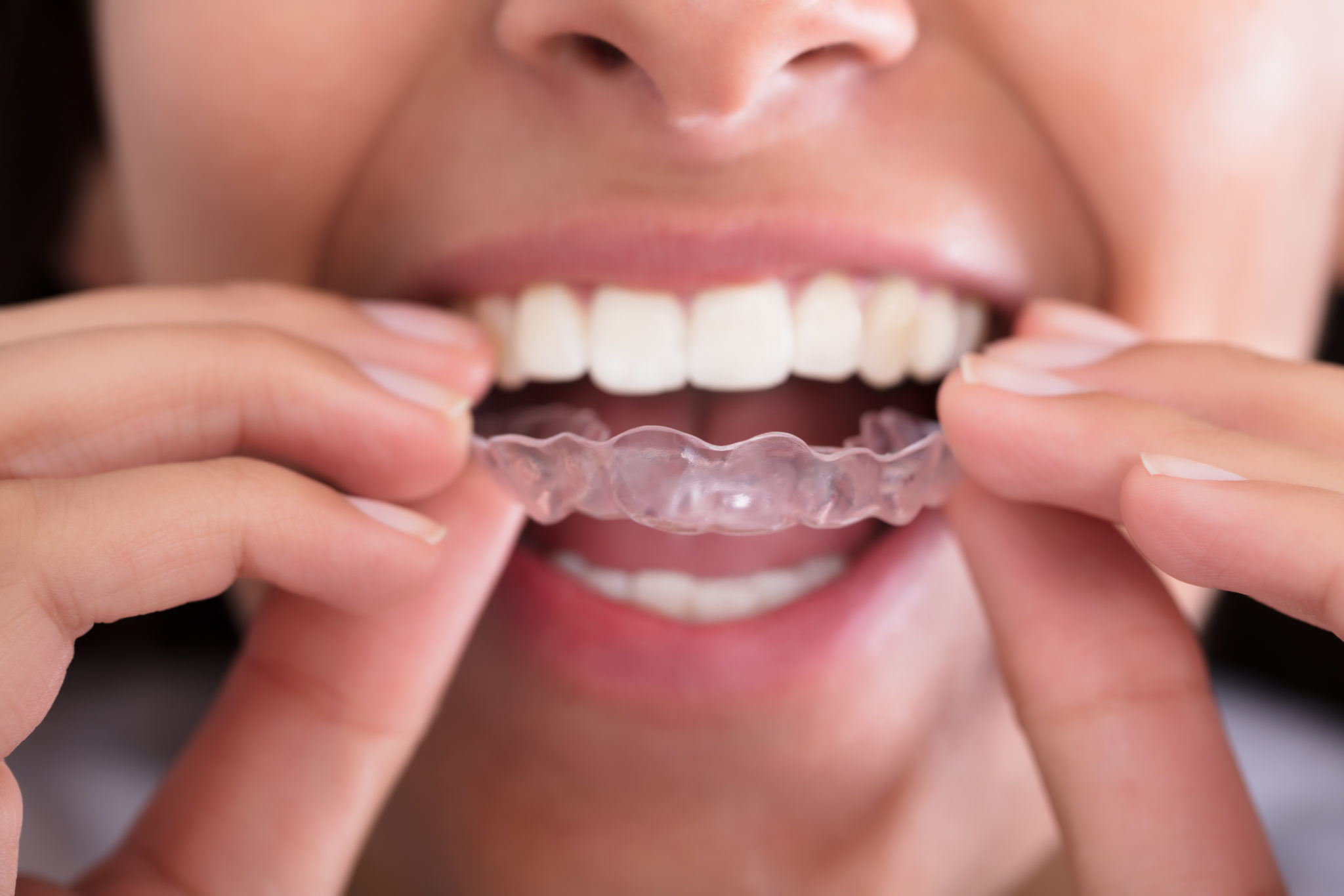 Tony Weir Orthodontics photo 2