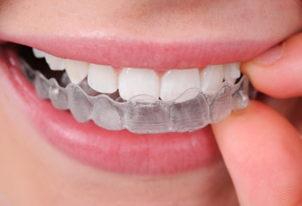 Smile Time Orthodontics photo 4